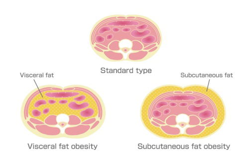 Blog Image: Excess Cortisol Influences Fat Distribution