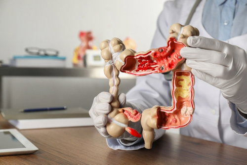 Blog Image: Improving Gut Health for Weight Control