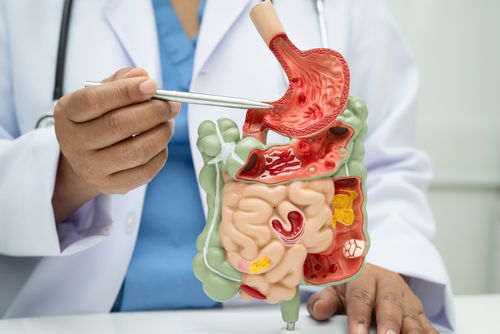 Blog Image: Gut Food to Help You Lose Weight