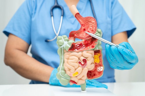 Blog Image: Low Carb Veggies for Gut Health